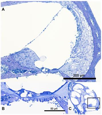 The effects of mild hypothermia on the electrode insertion trauma in a murine whole organ cochlea culture